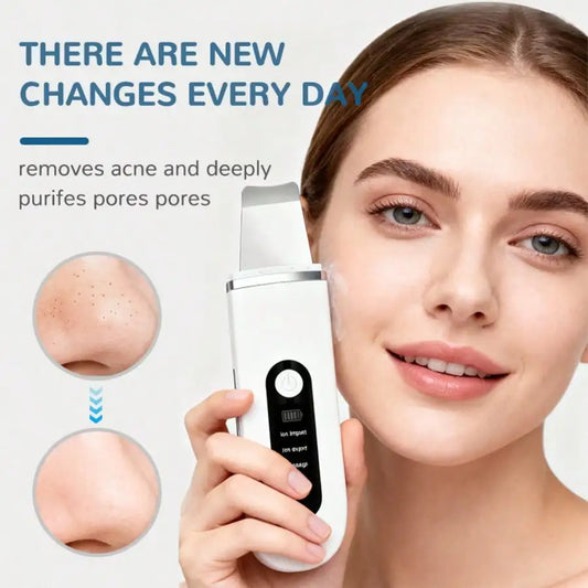 Ultrasonic Skin Cleaning Tool - USB Rechargeable, Vibrating Facial Blackhead Remover, Spatula Exfoliating Beauty Tool, Affordable Skincare Equipment, 4 Modes, The Perfect Tool For Removing Blackheads